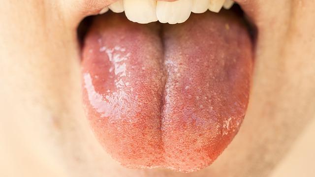 Teste de saliva para diagnóstico do Covid-19