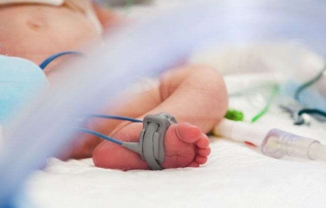 bebê prematuro em UTI devido a sepse tardia