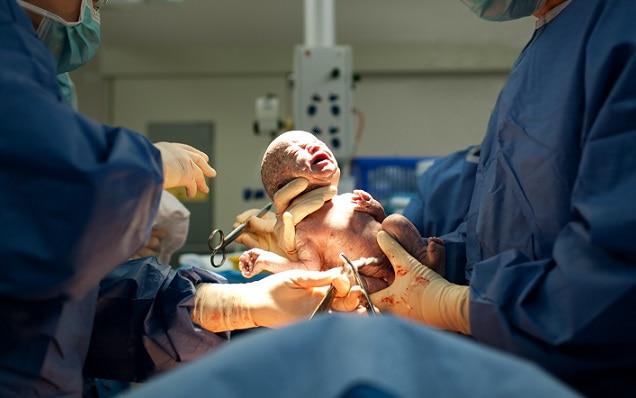 médico realizando uma cesárea