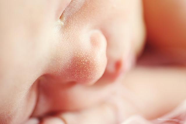 Terapia com surfactante minimamente invasivo não reduz a incidência de óbito ou broncodisplasia entre prematuros com SDR