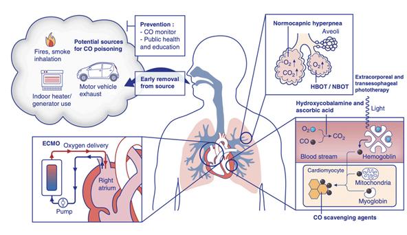 A intoxicação por monóxido de carbono (CO), uma causa importante de mortalidade, é tratada nesse artigo. Veja sobre.