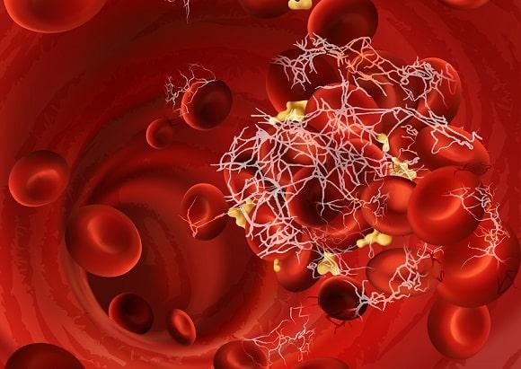 É possível utilizar métodos point-of-care para controle da anticoagulação na SAF