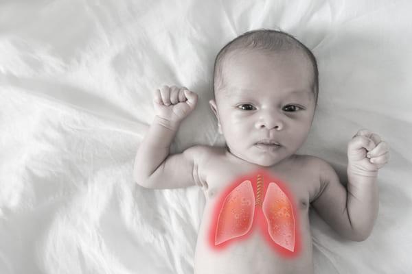 tuberculose congênita