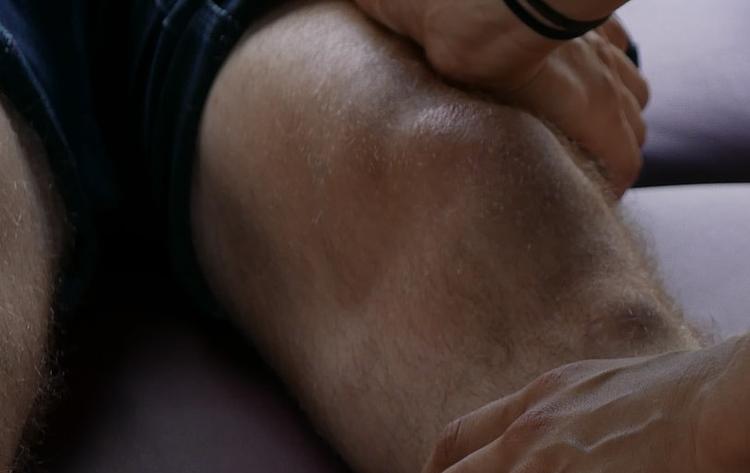 O tratamento cirúrgico das lesões meniscais degenerativas afeta a evolução da osteoartrite do joelho