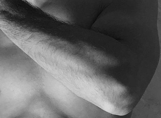 Quais são os resultados a longo prazo da osteotomia de encurtamento da ulna?