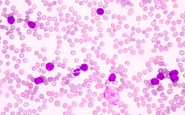 Anvisa importação de imunoglobulina humana poderá ser realizada até último dia de julho