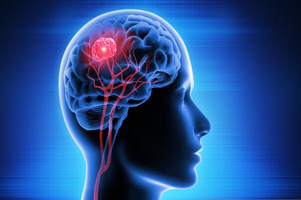 Em cirurgia de retirada de tumor cerebral, paciente realiza movimentos de braço e perna
