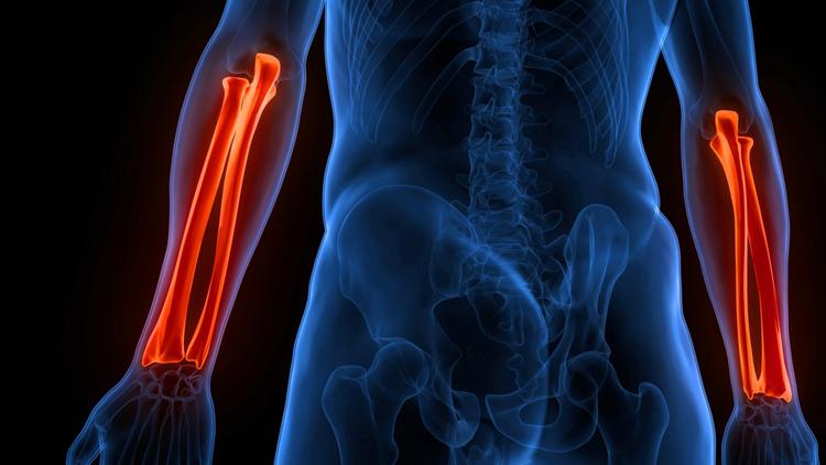 Qual é o melhor posicionamento da placa após osteotomia da ulna?