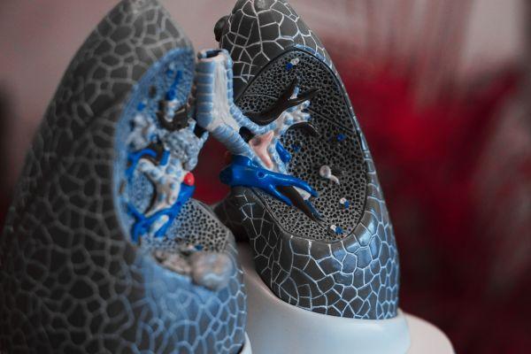 Doenças respiratórias: atualize seus conhecimentos em bronquiolite e outras