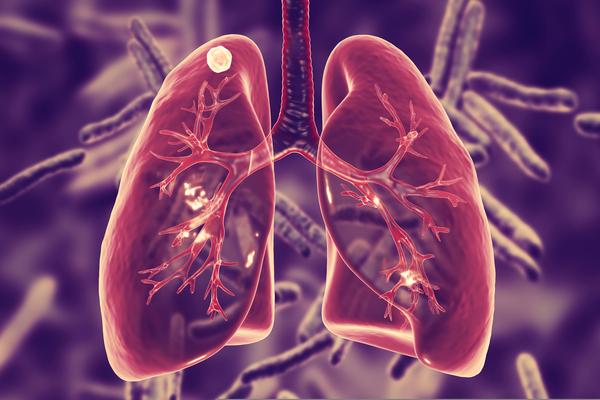 Fatores associados com abandono de tratamento de tuberculose no Brasil