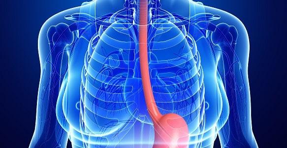 pós-bariátrica a prevalência de refluxo pode favorecer o quadro