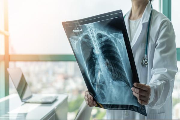 Governo cria comitê para erradicação da tuberculose até 2030
