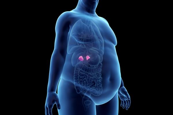 Síndrome de Cushing e hipercortisolismo: você sabe identificar corretamente?