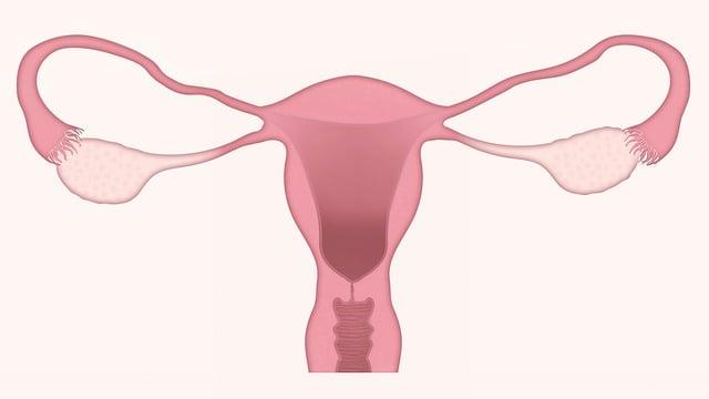 Dispositivos intrauterinos no manejo da hemorragia pós-parto