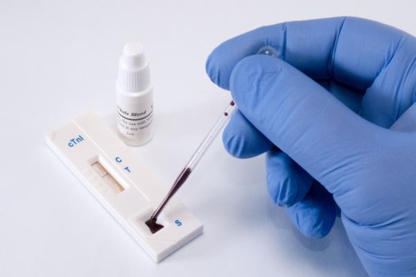 Médico manipulando teste de troponina ultrassensível