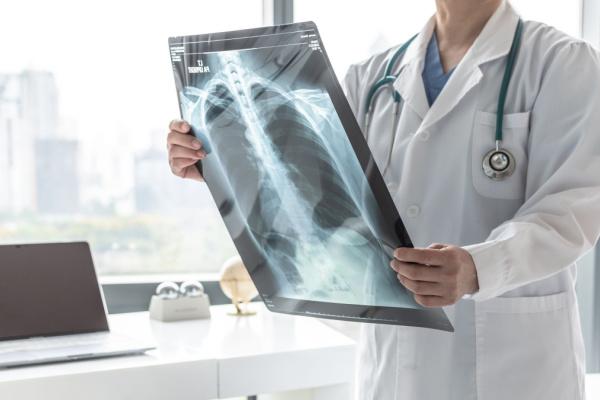 Aspergilose pulmonar