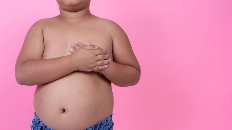 Obesidade infantil