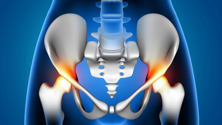 Frequência sonora ideal para fixação da copa acetabular não cimentada na ATQ?