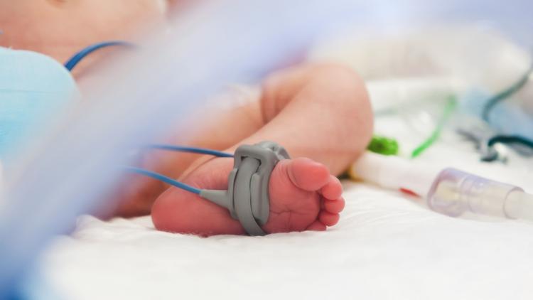 Bebês com bronquiolite submetidos à CNAF tiveram menos internações em UTIP