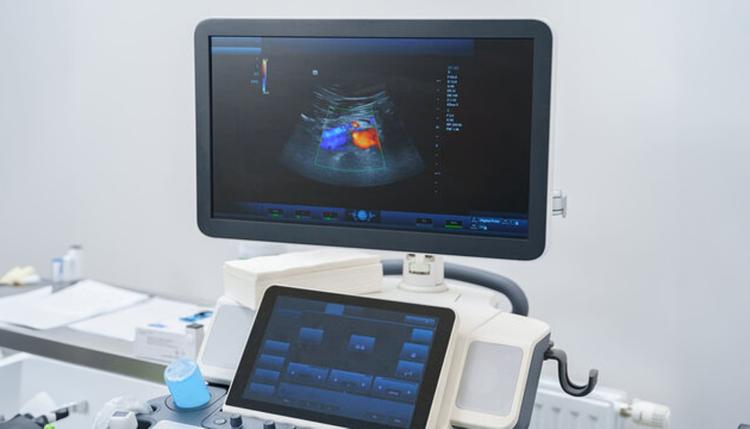 A ecocardiografia na predição de fluido-responsividade