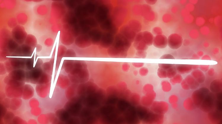 FA no pós-operatório de CRM: Anticoagular ou não?