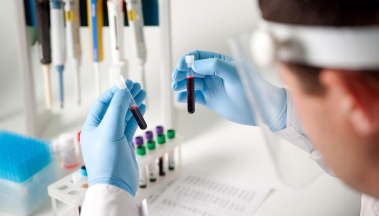 Médico examinando sangue de doença falciforme