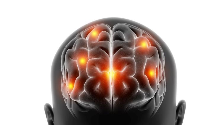 Acidente vascular encefálico isquêmico: Onde estamos em 2024?