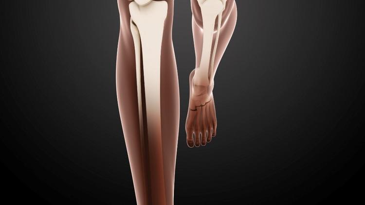 Placas bloqueadas versus haste intramedular na fixação de fraturas da tíbia