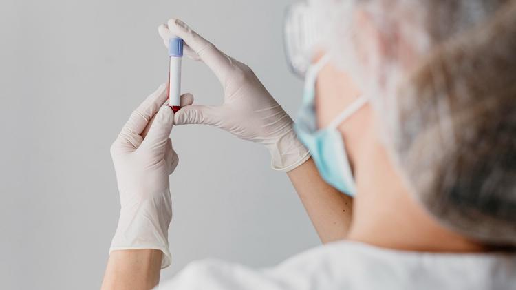 Enzimas pancreáticas: Há um exagero na solicitação?