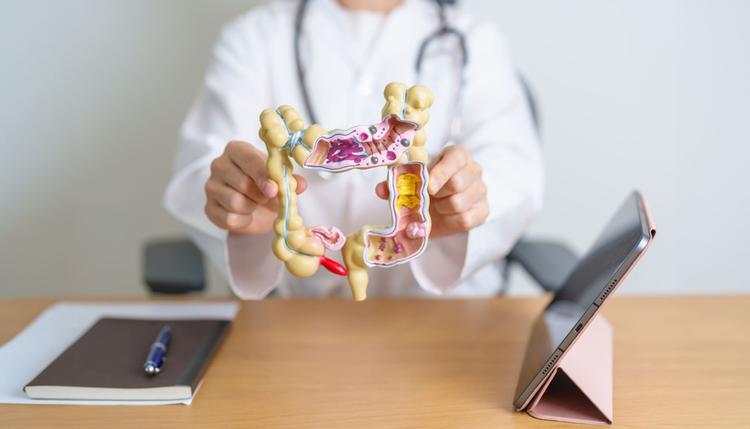 terapia combinada e doenças intestinais inflamatórias