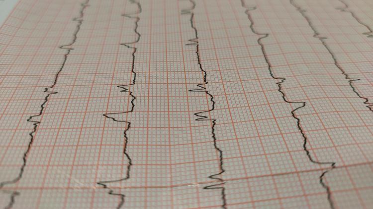 ESC 2024: Um resumo sobre as quatro novas diretrizes apresentadas