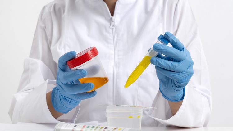 Performance de exame de urina para diagnóstico de infecção urinária