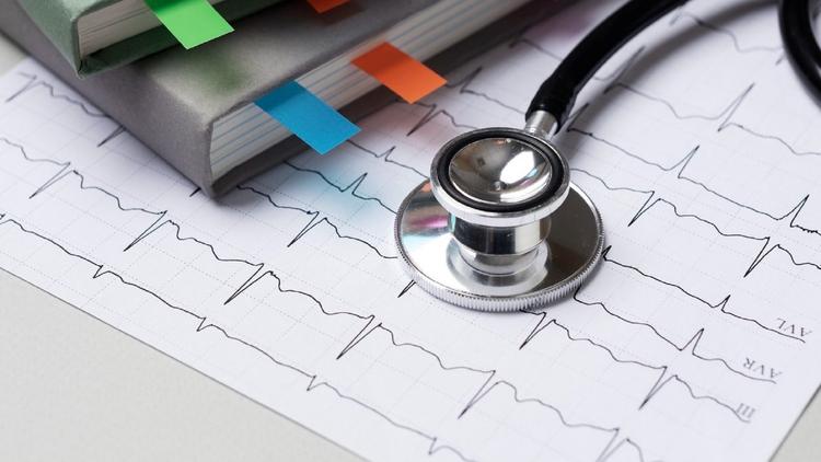 Nova nomenclatura para as síndromes isquêmicas do miocárdio