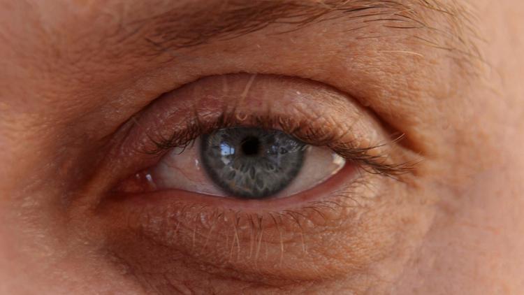 Abordagens terapêuticas para tratar a a coriorretinopatia serosa central crônica