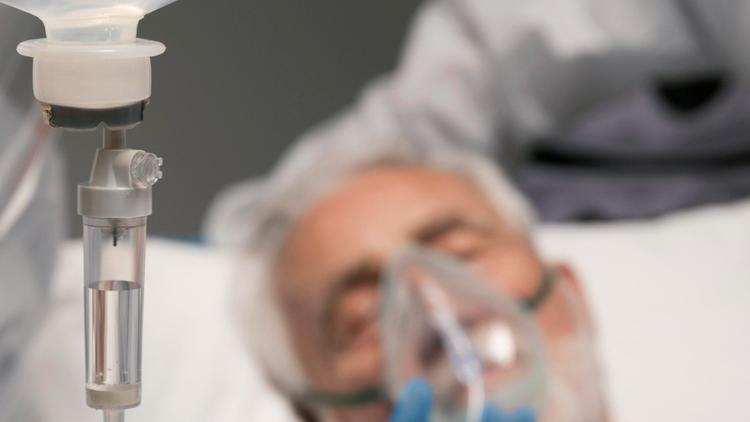 BIS vs avaliação RASS para monitorar sedação do paciente em VM