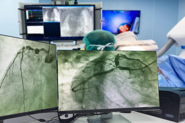 Por que estamos tendo dificuldade em realizar exames com contraste?