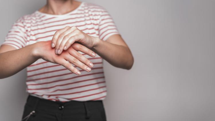 Como prevenir doenças cardiovasculares em pacientes reumatológicos?