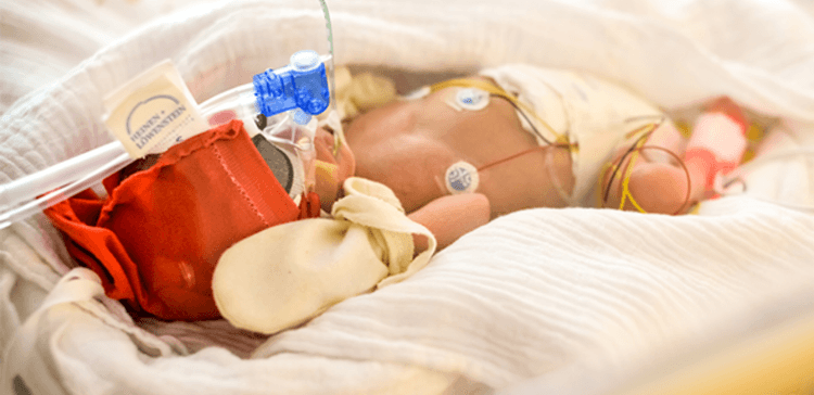 CPAP no ventilador mecânico versus CPAP em bolhas