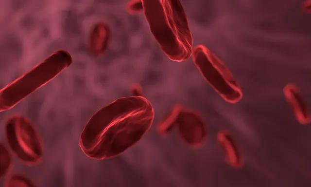 Como deve ser feita a avaliação de criança com suspeita de anemia hemolítica?