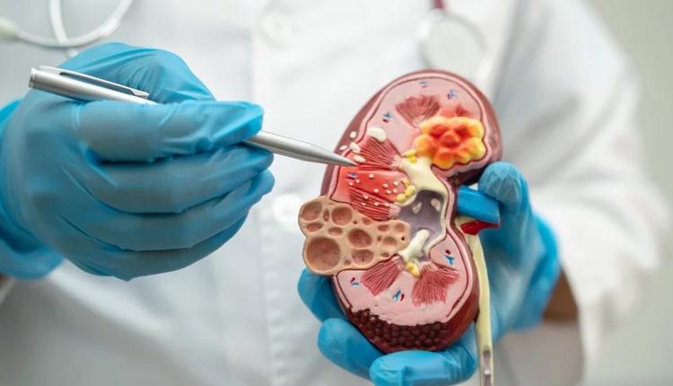SHU: uma das principais causas de lesão renal aguda em pediatria