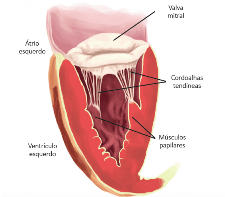 Paciente vai para revascularização miocárdica e tem refluxo mitral associado: o que fazer?