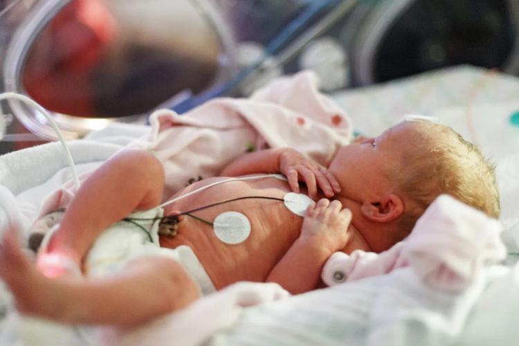 Hipotermia e prematuridade