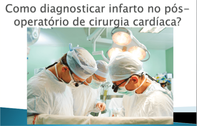 Videoaula: como diagnosticar infarto no pós-operatório de cirurgia cardíaca?