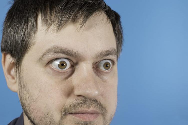 Novo guideline europeu de orbitopatia de graves – as principais recomendações