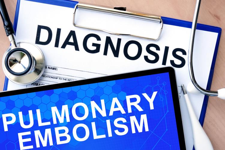 Devo me preocupar com embolia pulmonar em paciente com síncope?