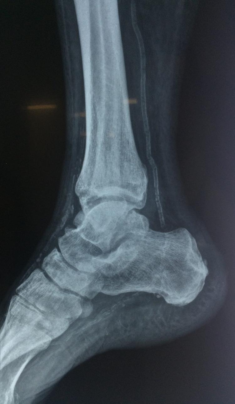 Desafio – o que chama atenção na radiografia?
