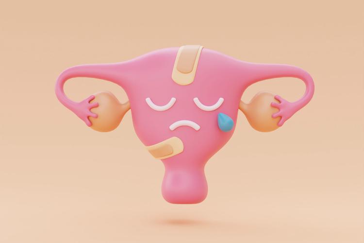 Diagnóstico e diferença das malformações uterinas