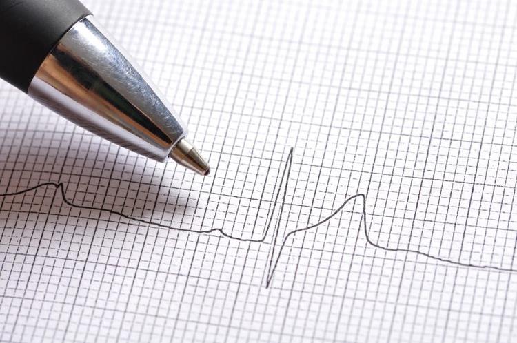 Sabe quais as causas de onda R ampla em V1 e V2? Aprenda de forma fácil com nosso mnemônico.