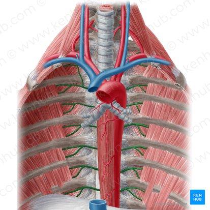Aneurismas de Aorta Torácicos. Quando Operar?