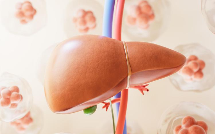 Qual é o melhor antidiabético oral para pacientes com esteatose hepática?
